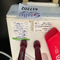 Mettler Toledo UMX2 Microbalance System image 0